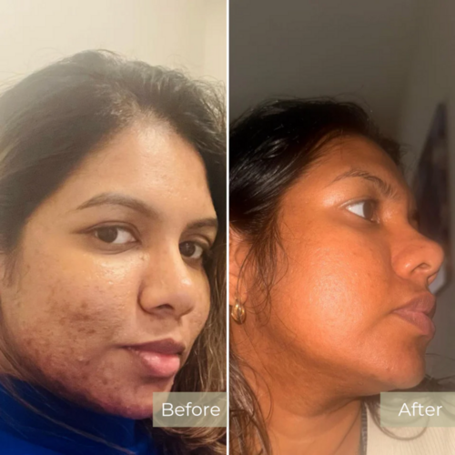 Before and After Results 1
