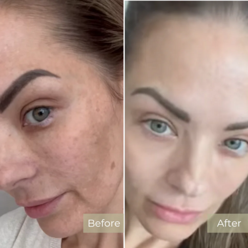 Before and After Results 2