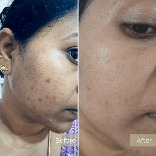 Before and After Results 3