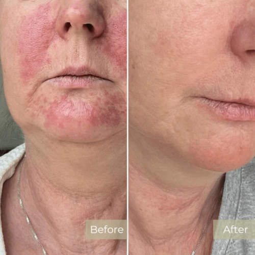 Before and After Results 4