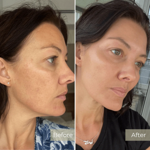 Before and After Results 5