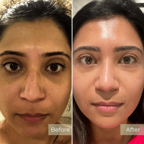 Before and After Results 6