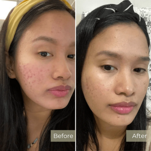 Before and After Results 7
