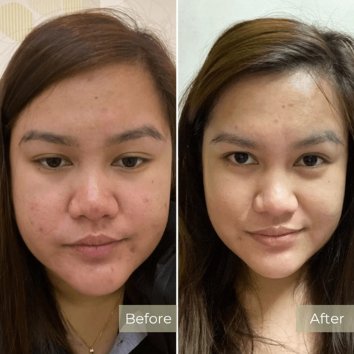 Before and After Results 8