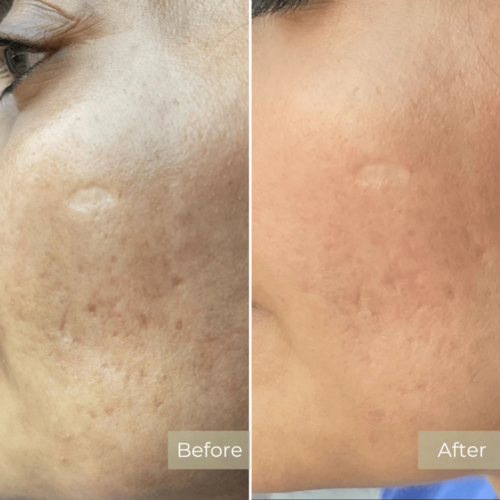 Before and After Results 9