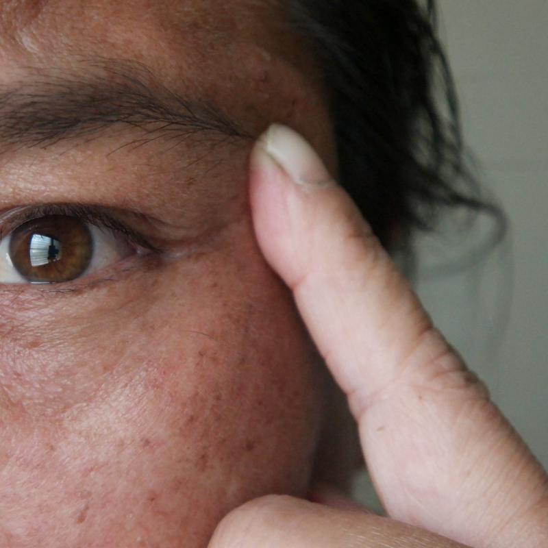 Best Pigmentation Serum and Hyperpigmentation KJ Serums. Try Pigmentation Removal Serum or Discoloration Serum for clear Skin. 