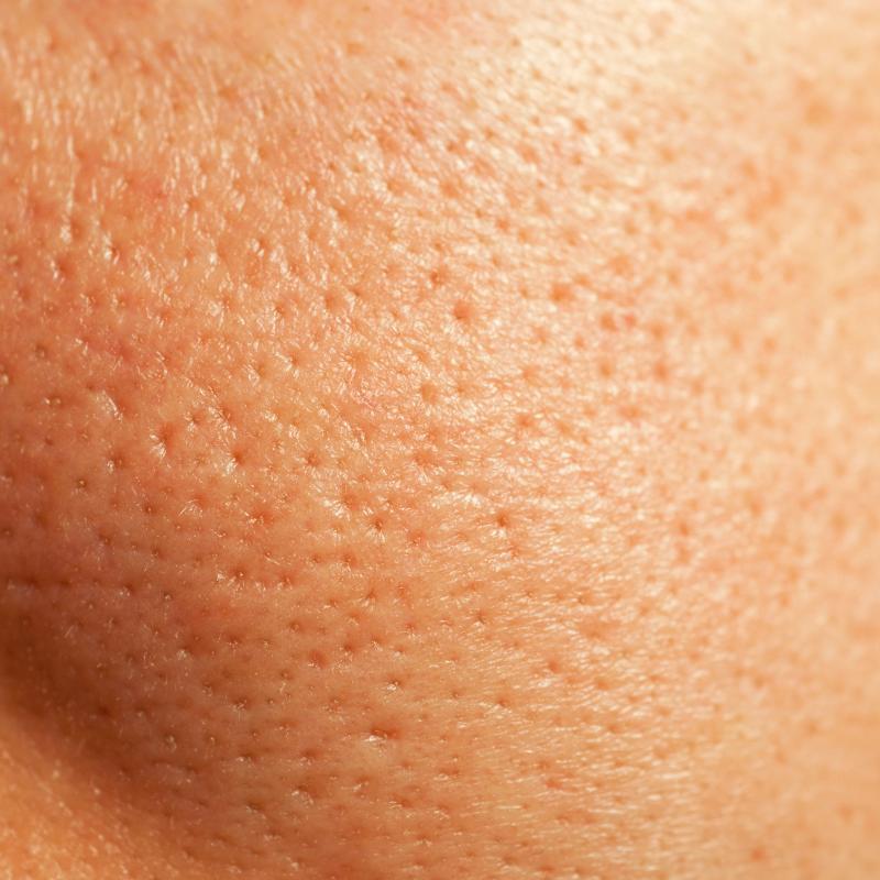 Best Serum for Open Pores by KJ Serums. Pore Minimiser Serum. Best Pore tightening Products.  