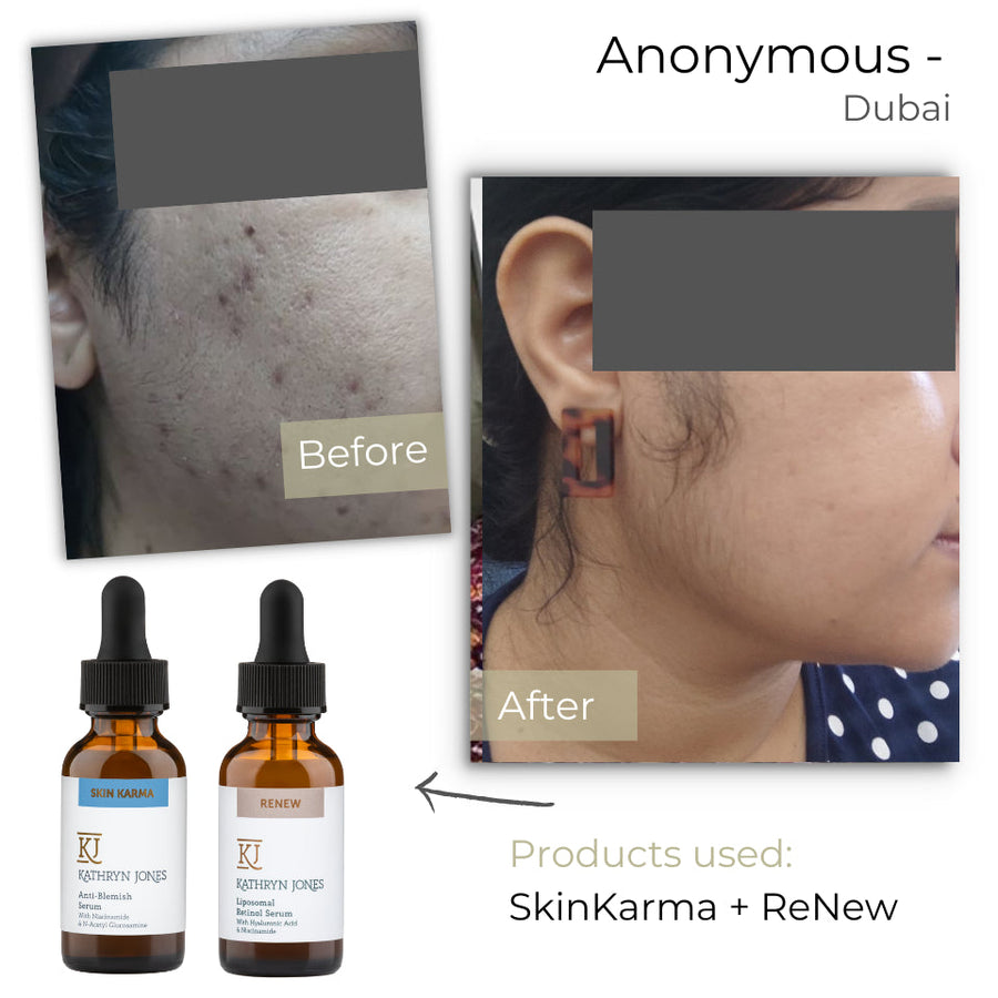 Anonymous before and after skincare results