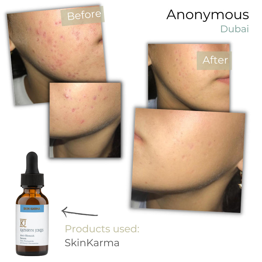 Anonymous before and after skincare results