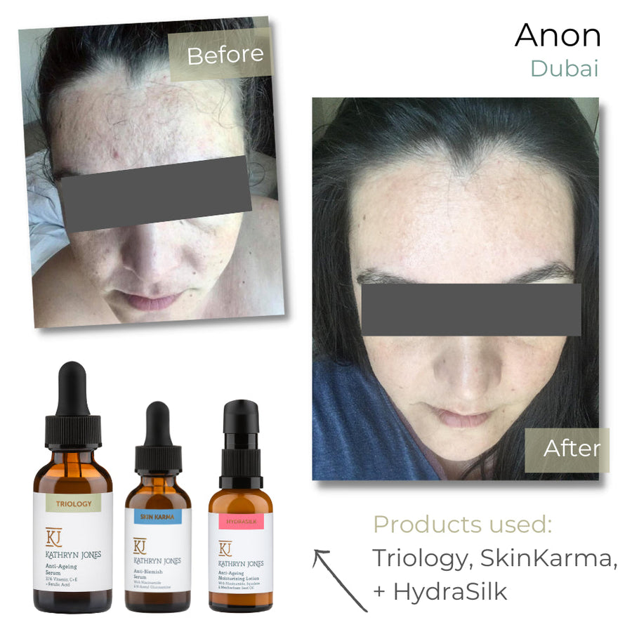 Anonymous before and after skincare results