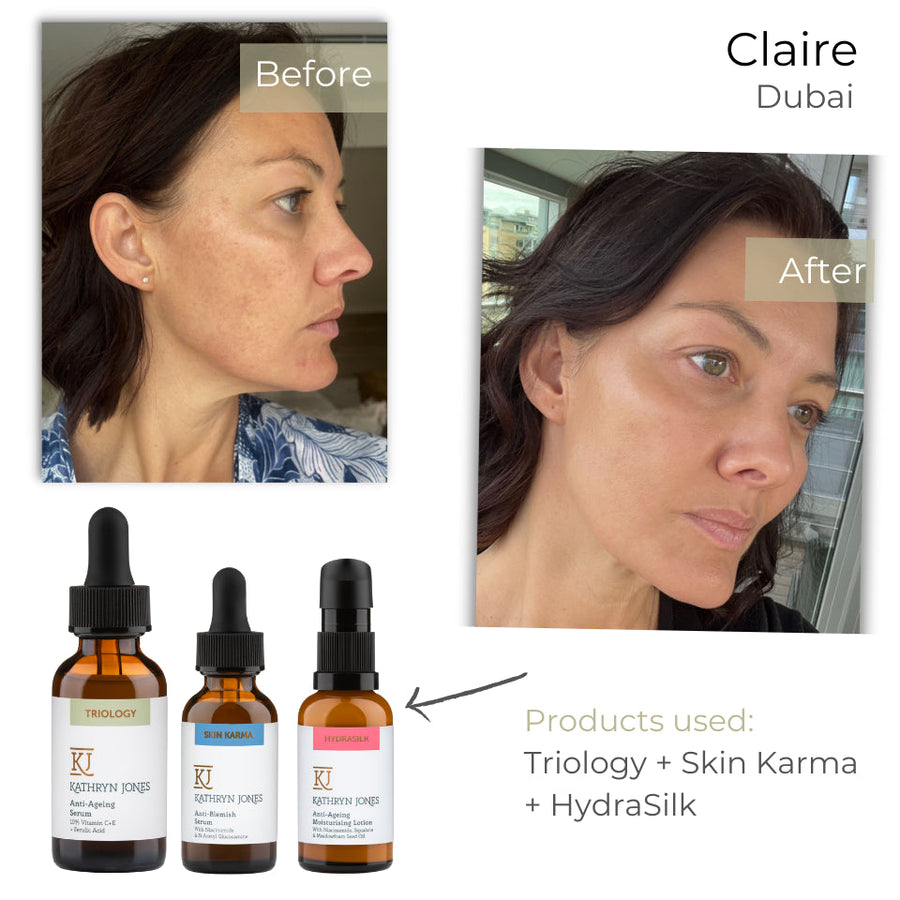 Claire before and after skincare results