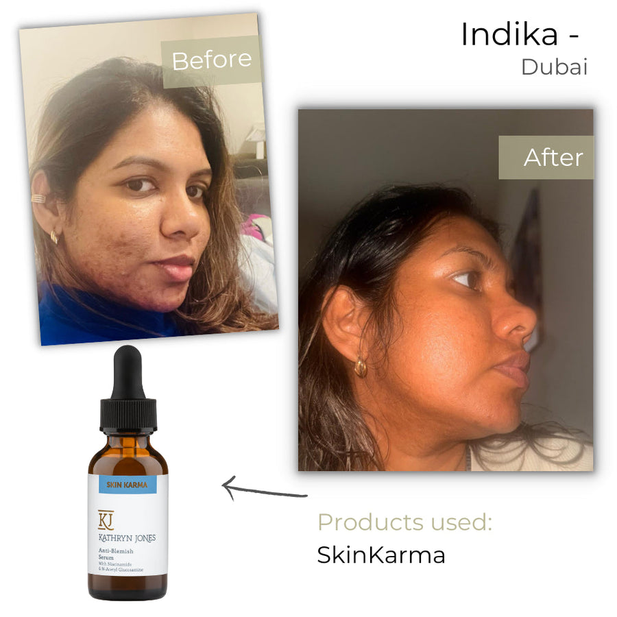 Indika before and after skincare results
