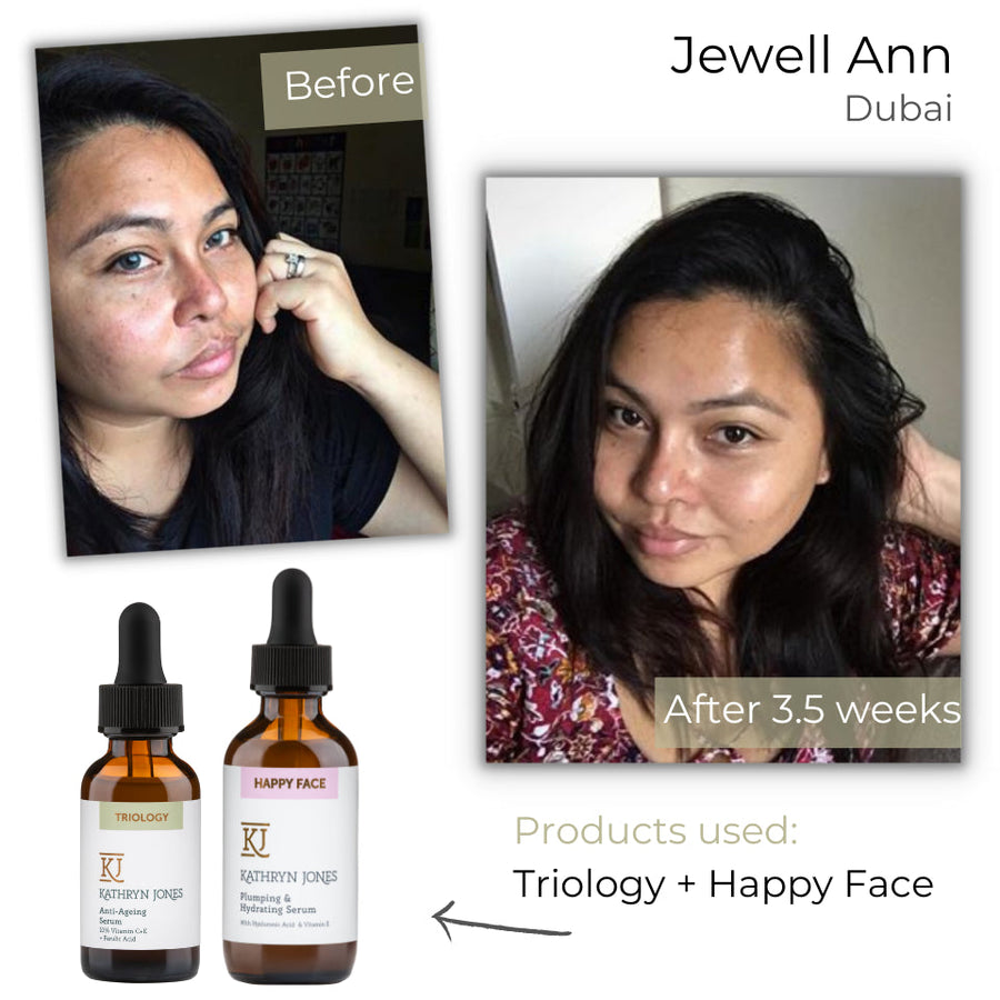 Jewell Ann before and after skincare results