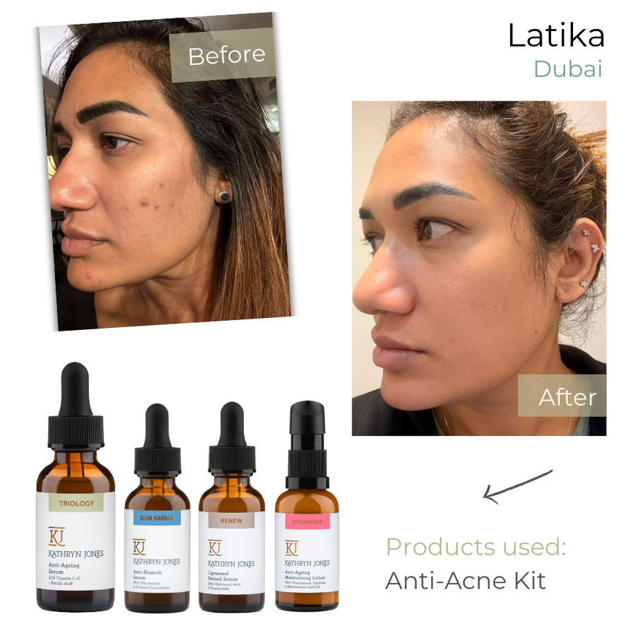 Latika before and after skincare results