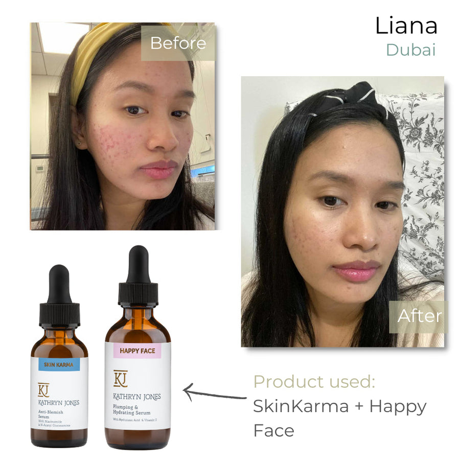 Liana before and after skincare results