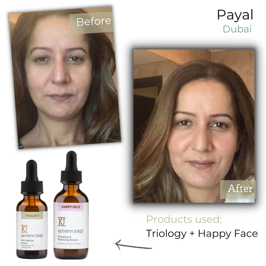 Payal before and after skincare results
