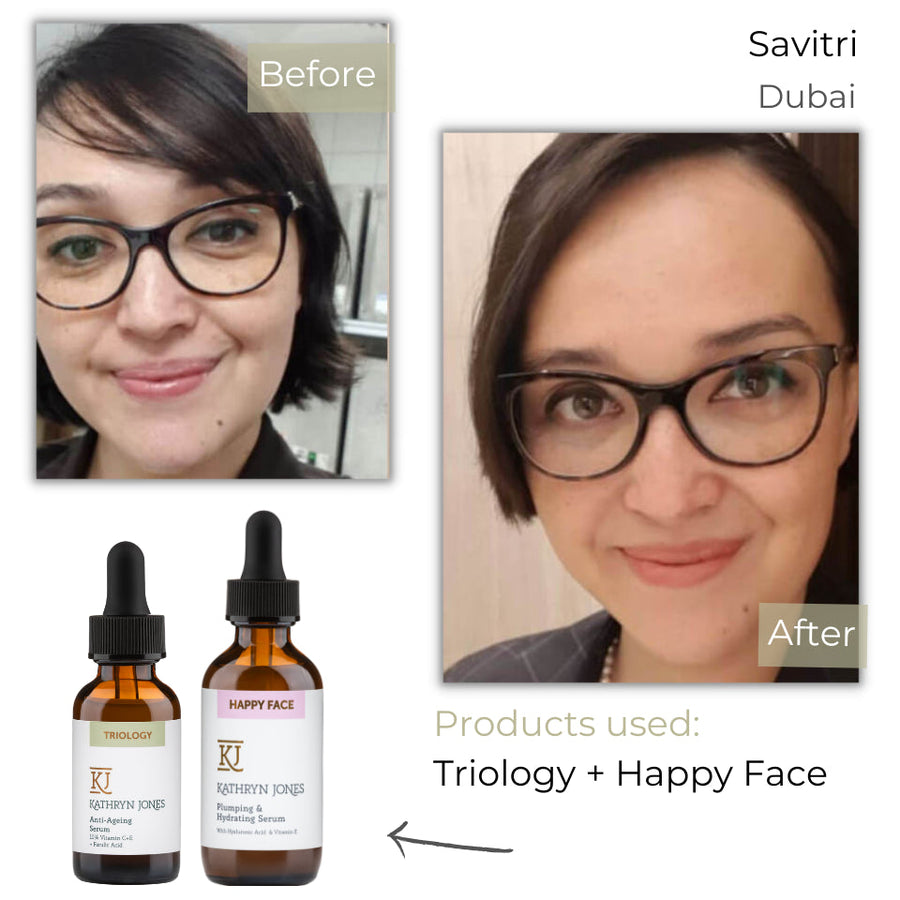 Savitri before and after skincare results