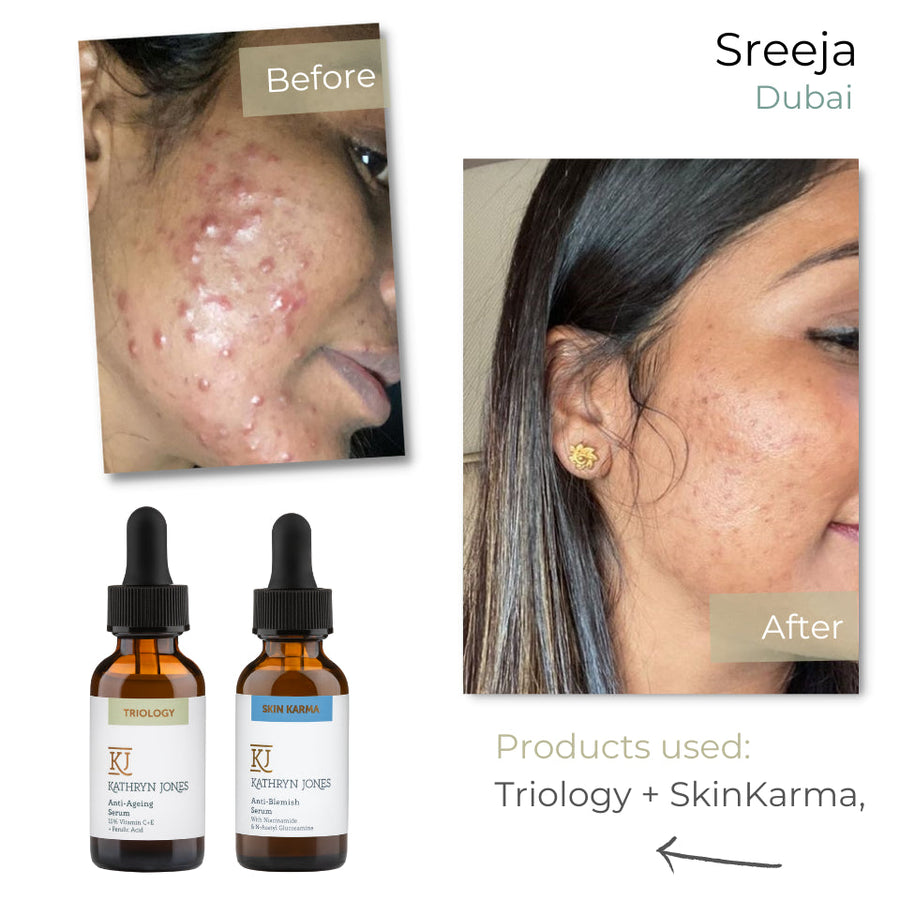 Sreeja before and after skincare results