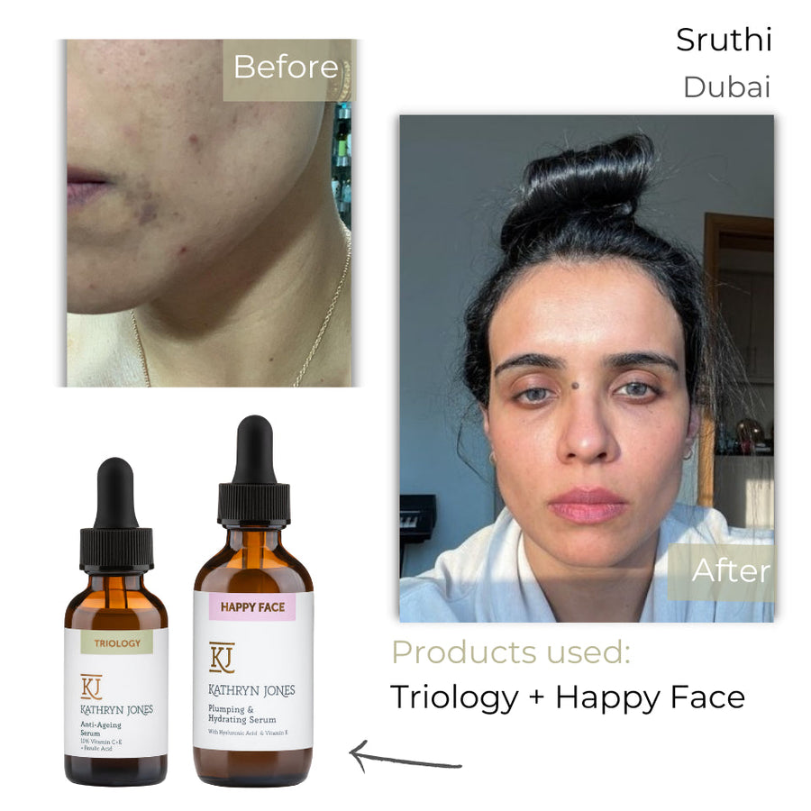 Sruthi before and after skincare results