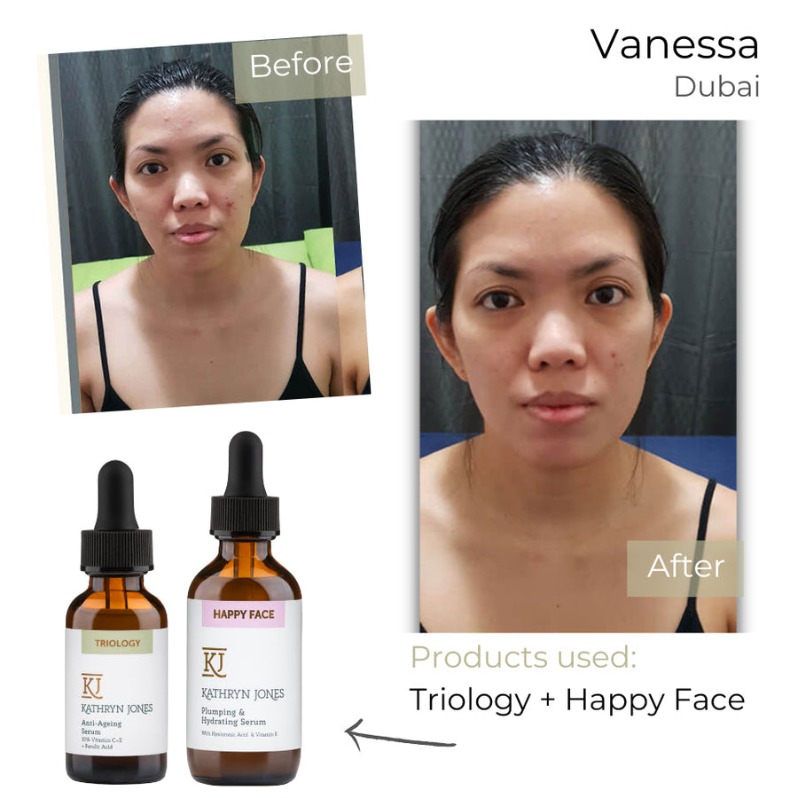 Vanessa before and after skincare results